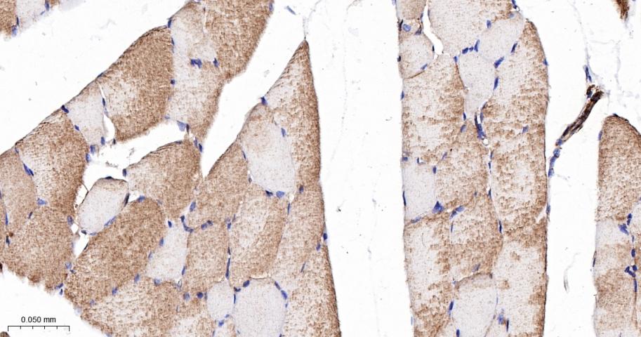 肌球蛋白调节轻链12B重组兔单抗