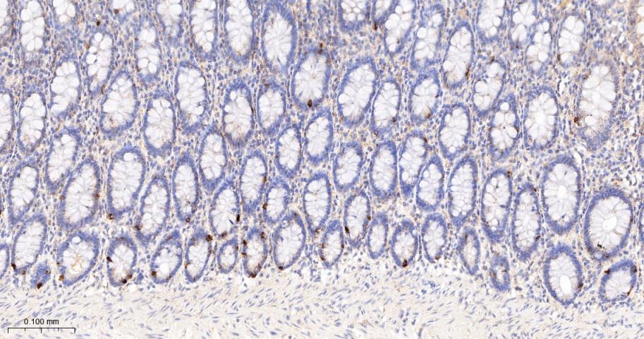 金属蛋白酶组织抑制因子-1重组兔单抗