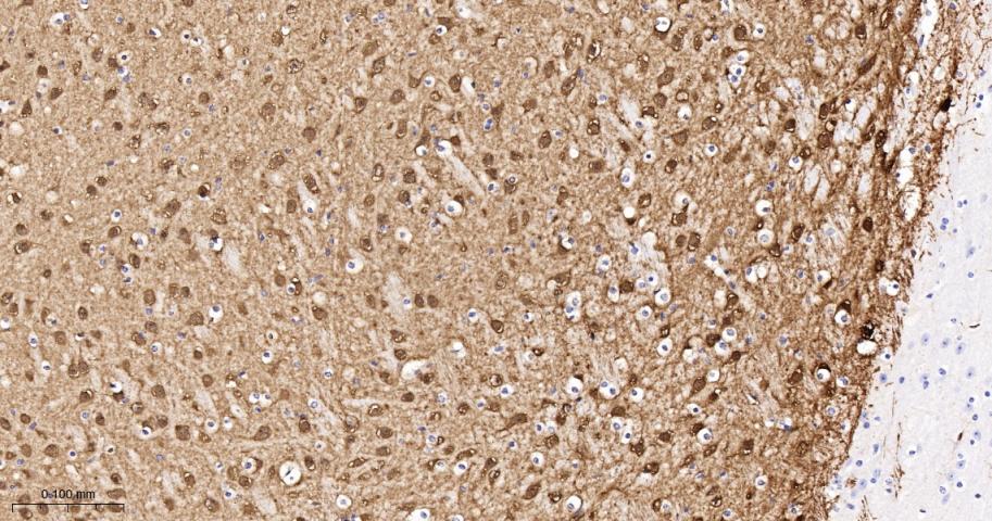 蛋白激酶C亚性D型重组兔单抗
