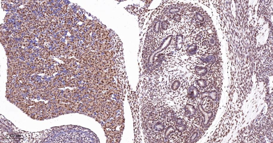 核糖核酸结合蛋白1重组兔单抗-bsm-60550R