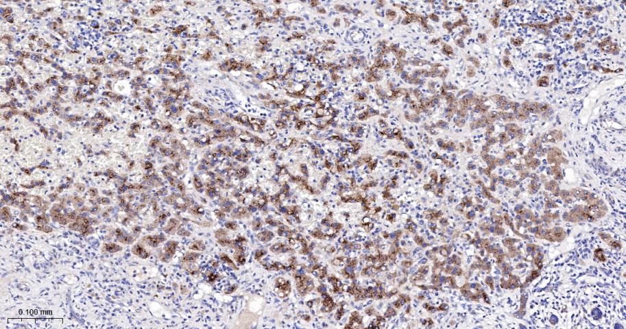 肉毒碱棕榈酰基转移酶2重组兔单抗