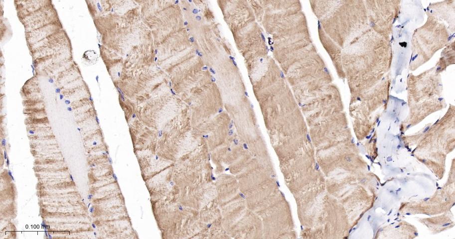 肌球蛋白调节轻链12B重组兔单抗