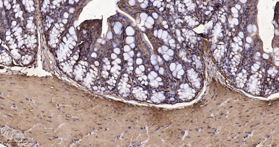 肌球蛋白调节轻链12B重组兔单抗