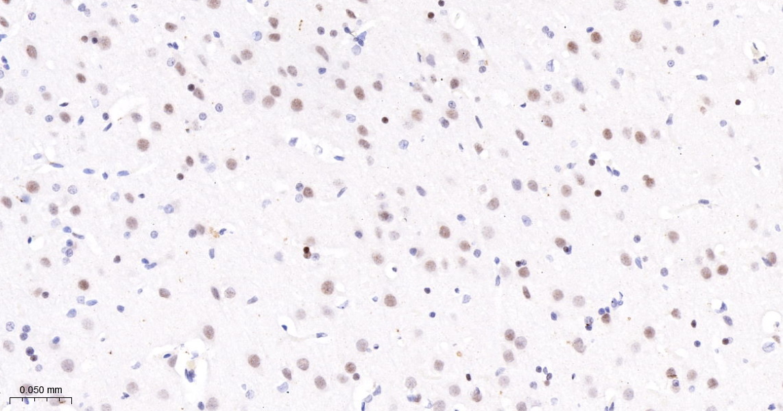 转录因子7类似物2重组兔单抗