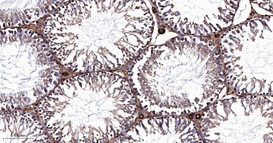 肌球蛋白调节轻链12B重组兔单抗