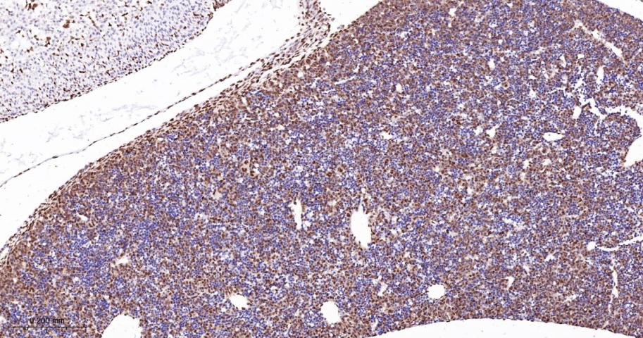 核糖核酸结合蛋白1重组兔单抗-bsm-60550R