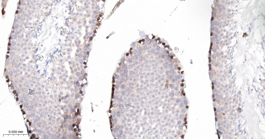 蛋白激酶C亚性D型重组兔单抗
