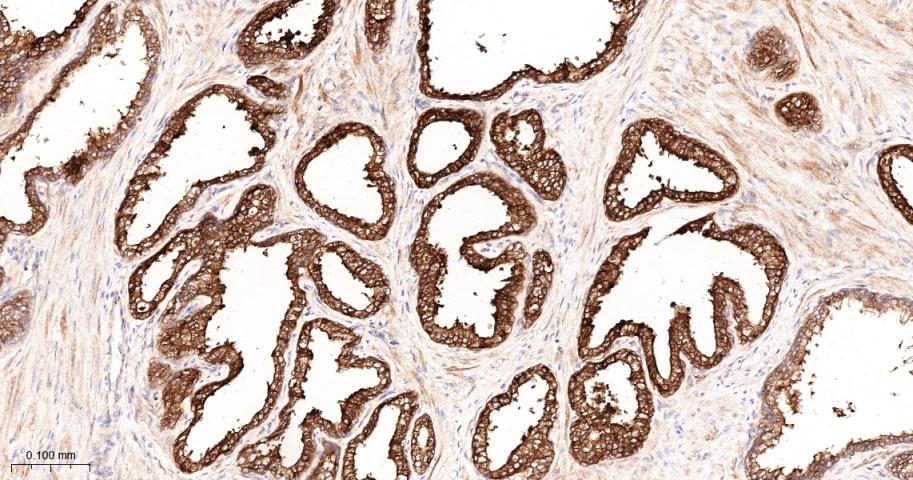 金属蛋白酶组织抑制因子-1重组兔单抗
