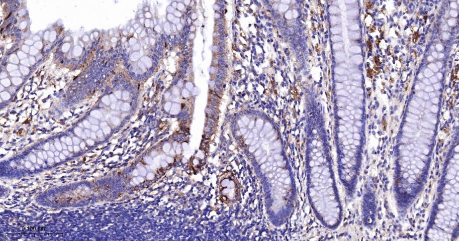 肉毒碱棕榈酰基转移酶2重组兔单抗