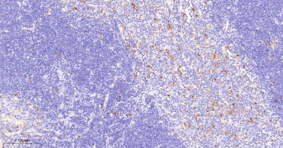 干扰素调节因子5重组兔单抗