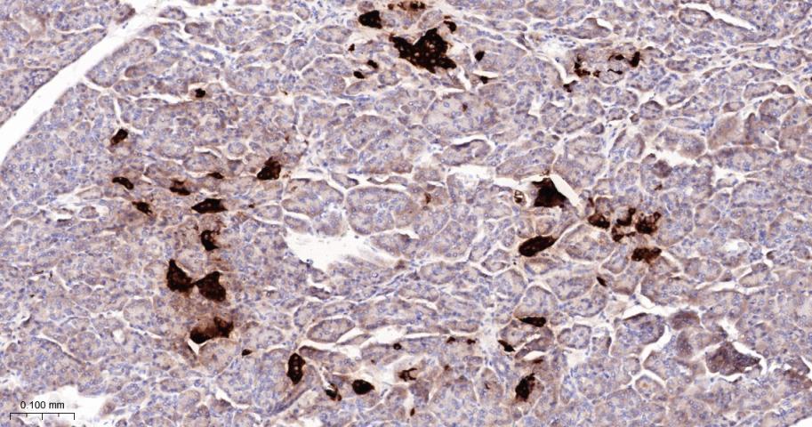 金属蛋白酶组织抑制因子-1重组兔单抗