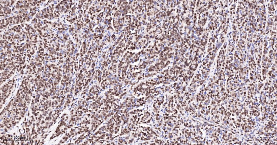 核糖核酸结合蛋白1重组兔单抗-bsm-60550R