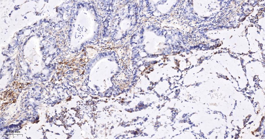 干扰素调节因子5重组兔单抗