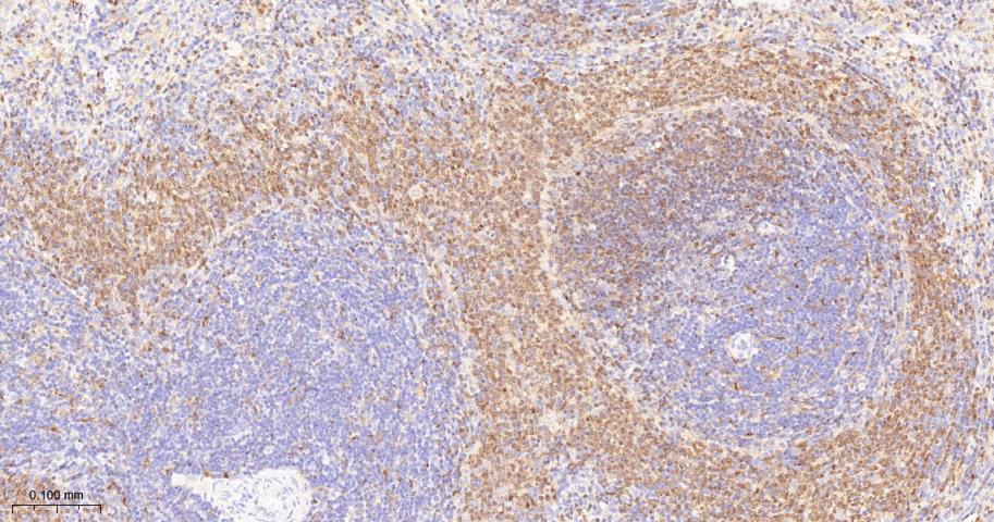 干扰素调节因子5重组兔单抗