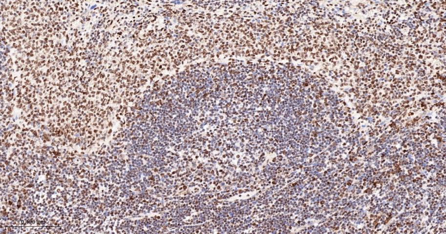 核糖核酸结合蛋白1重组兔单抗-bsm-60550R