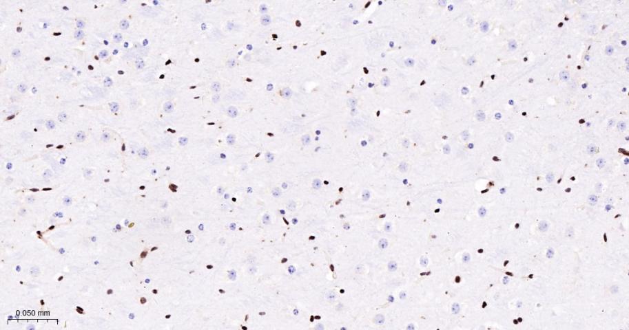 核糖核酸结合蛋白1重组兔单抗-bsm-60550R