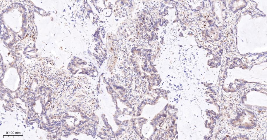 金属蛋白酶组织抑制因子-1重组兔单抗