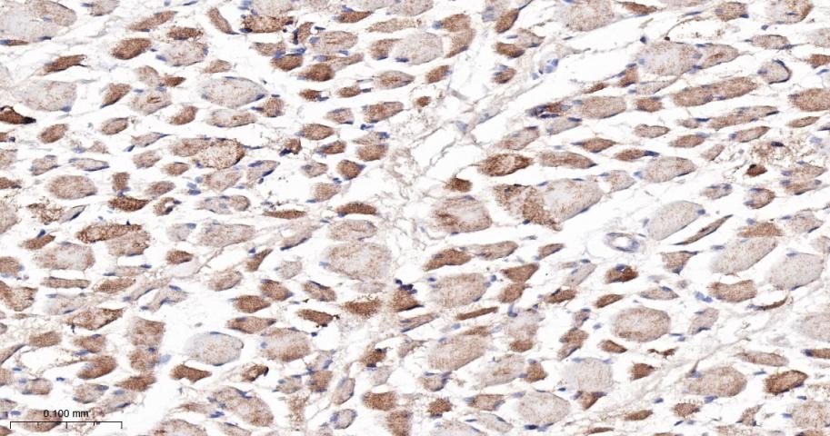 肉毒碱棕榈酰基转移酶2重组兔单抗