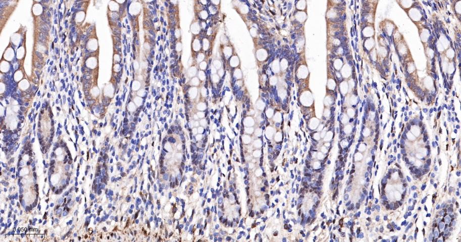 原癌基因Yes相关蛋白1重组兔单抗