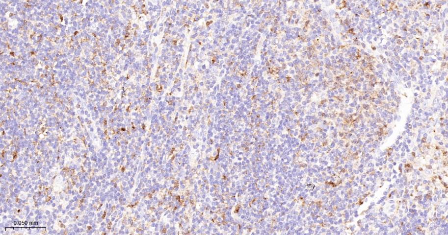 干扰素调节因子5重组兔单抗