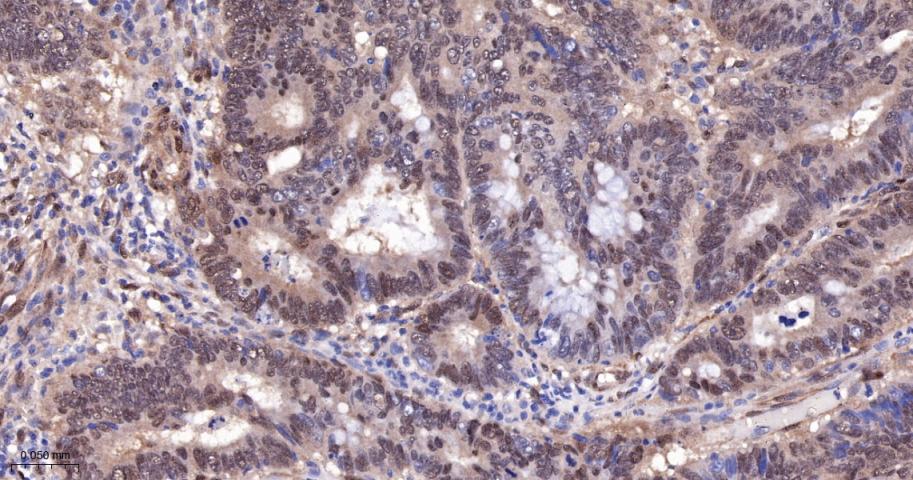 原癌基因Yes相关蛋白1重组兔单抗