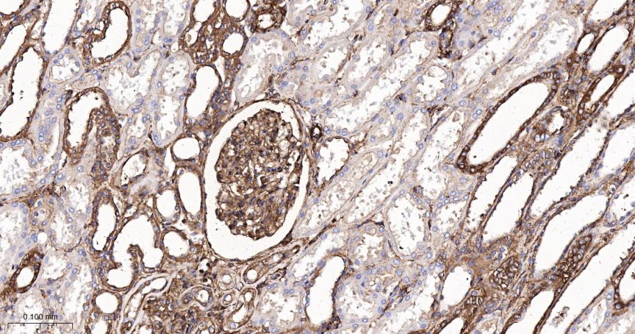肌球蛋白调节轻链12B重组兔单抗