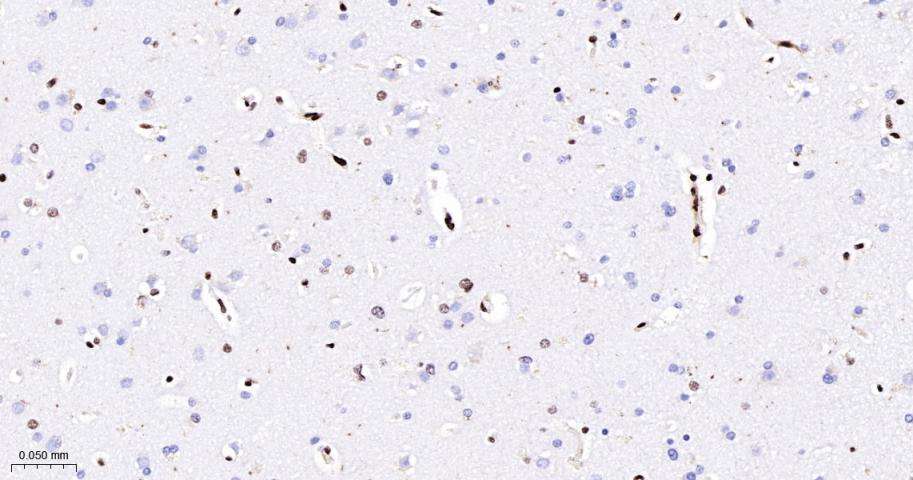 核糖核酸结合蛋白1重组兔单抗-bsm-60550R