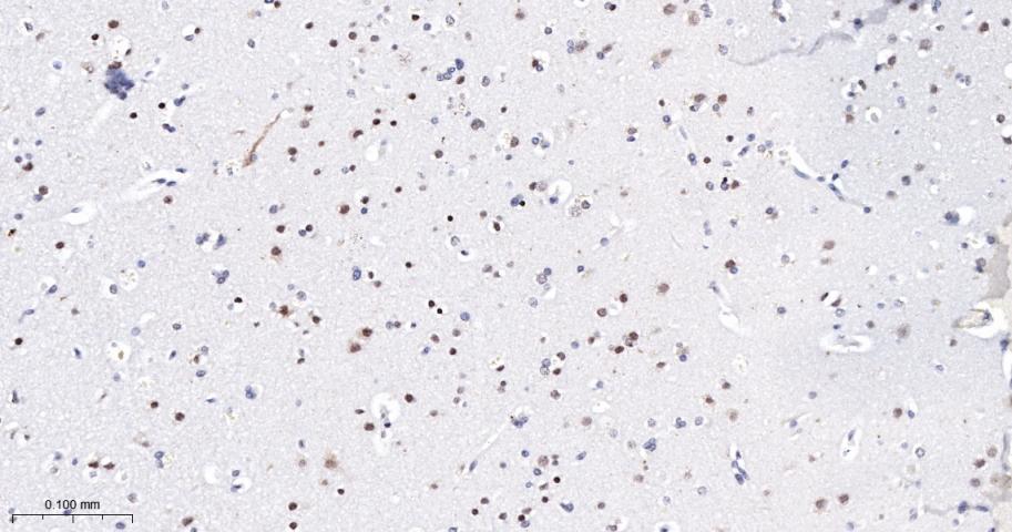 转录因子7类似物2重组兔单抗