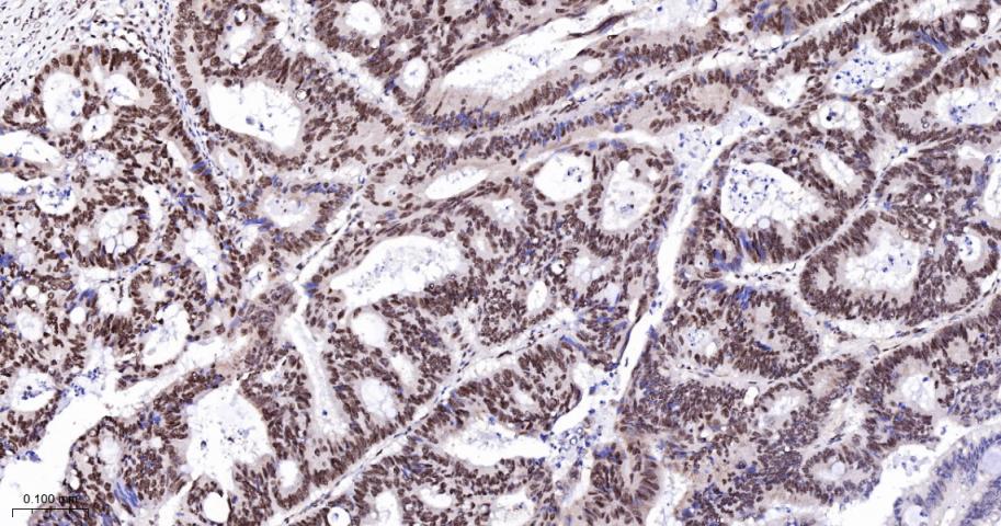 核糖核酸结合蛋白1重组兔单抗-bsm-60550R