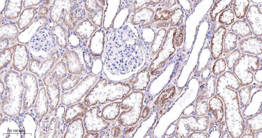 肉毒碱棕榈酰基转移酶2重组兔单抗
