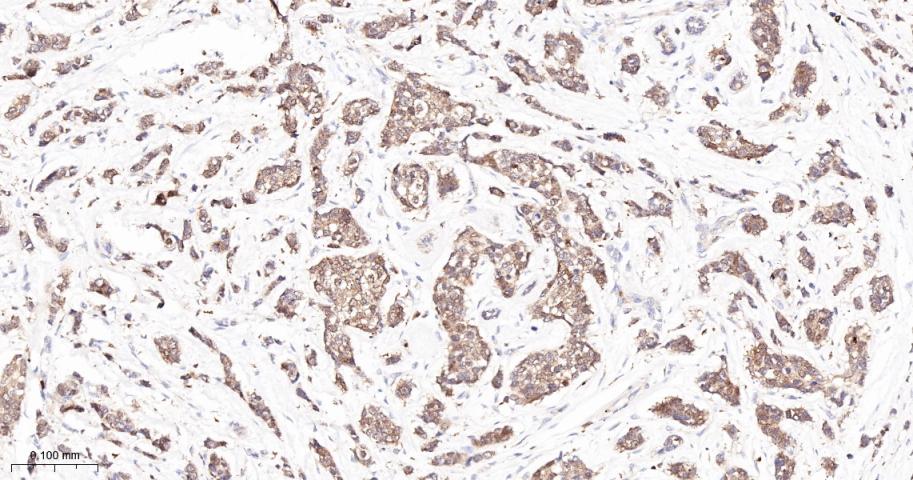 蛋白激酶C亚性D型重组兔单抗