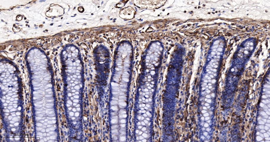 肌球蛋白调节轻链12B重组兔单抗