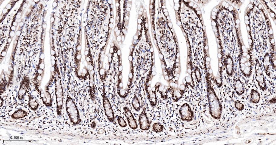 核糖核酸结合蛋白1重组兔单抗-bsm-60550R