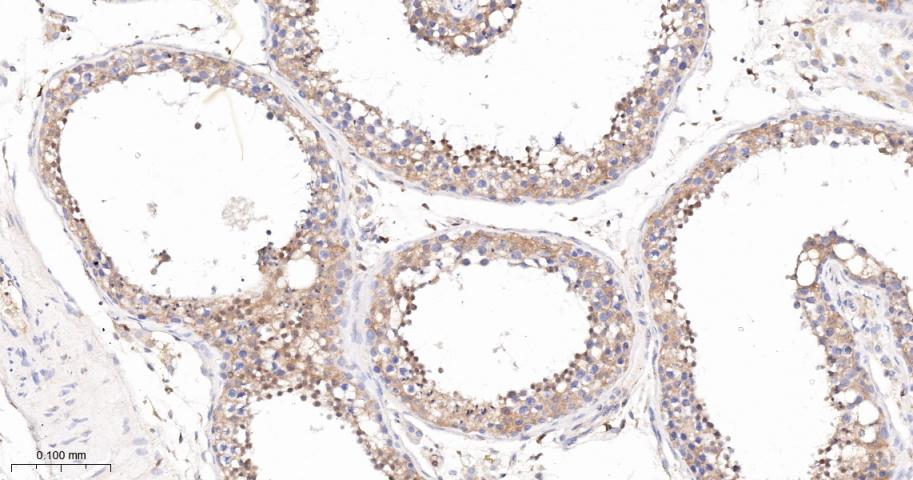 蛋白激酶C亚性D型重组兔单抗