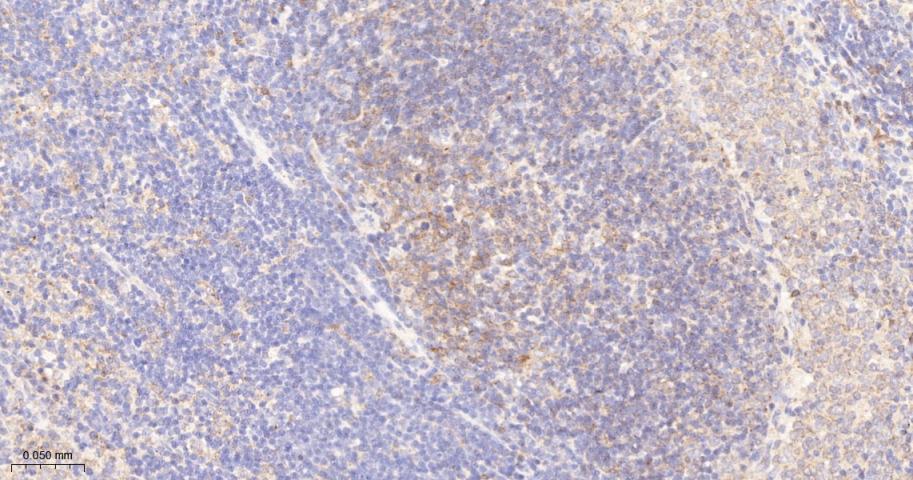 蛋白激酶C亚性D型重组兔单抗