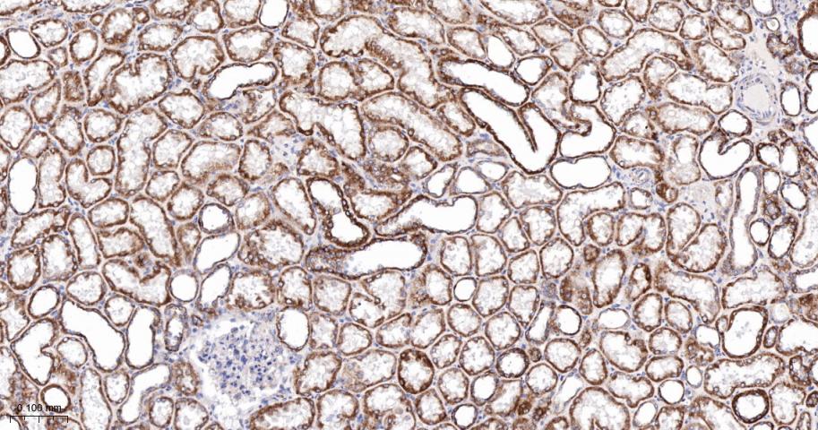 NDUFC2蛋白重组兔单抗