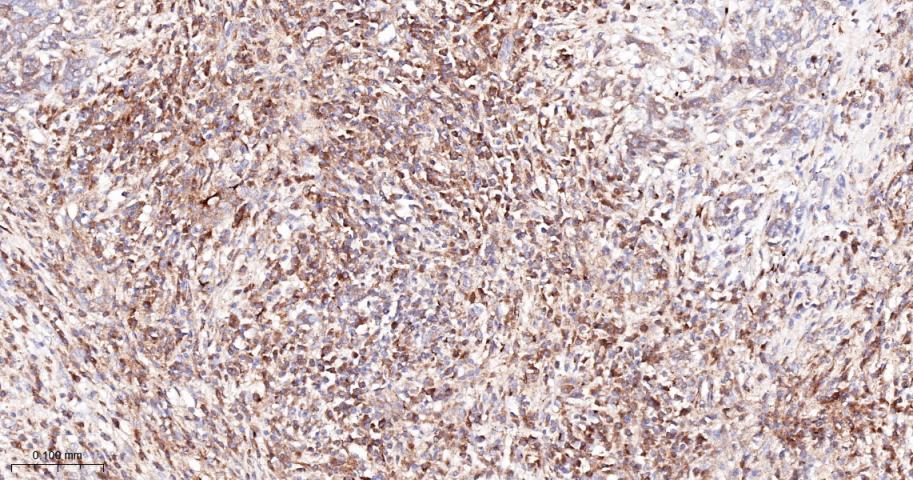 金属蛋白酶组织抑制因子-1重组兔单抗