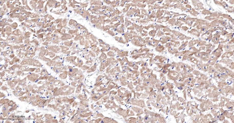 肉毒碱棕榈酰基转移酶2重组兔单抗