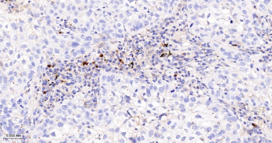 干扰素调节因子5重组兔单抗