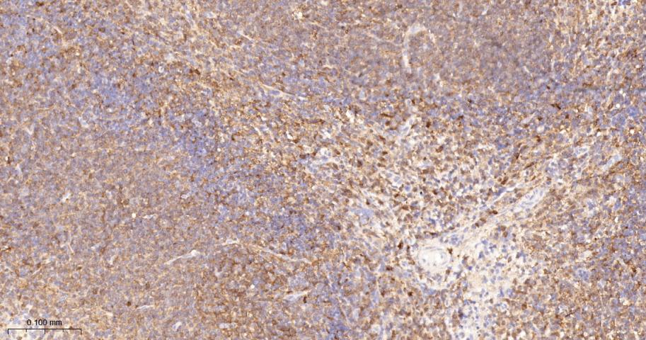 蛋白激酶C亚性D型重组兔单抗