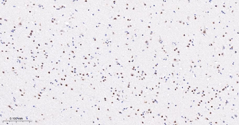 转录因子7类似物2重组兔单抗