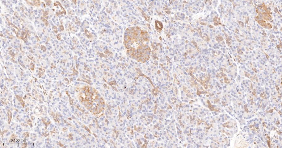 蛋白激酶C亚性D型重组兔单抗