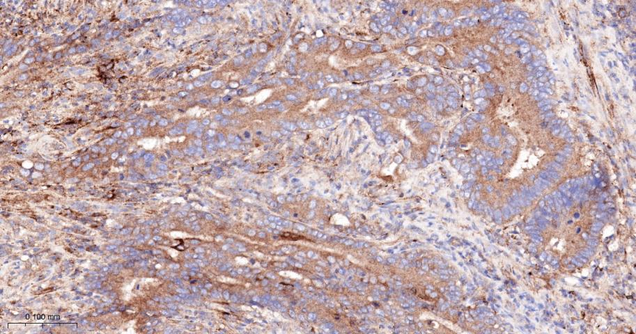 金属蛋白酶组织抑制因子-1重组兔单抗