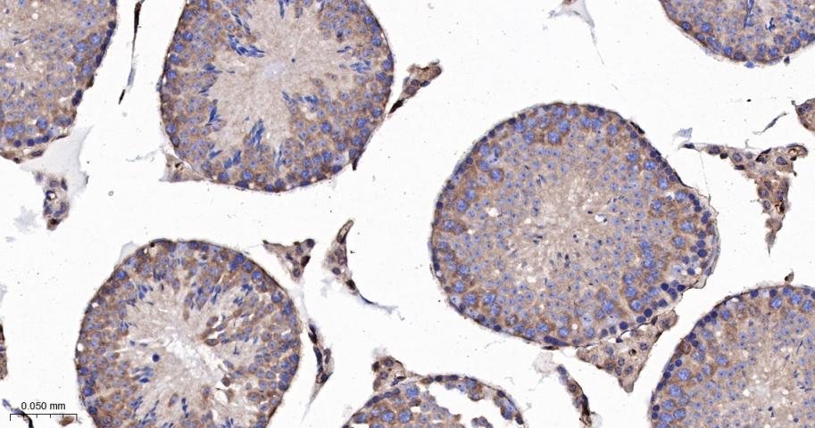 肌球蛋白调节轻链12B重组兔单抗