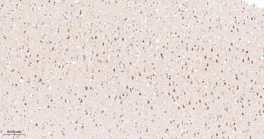 蛋白激酶C亚性D型重组兔单抗