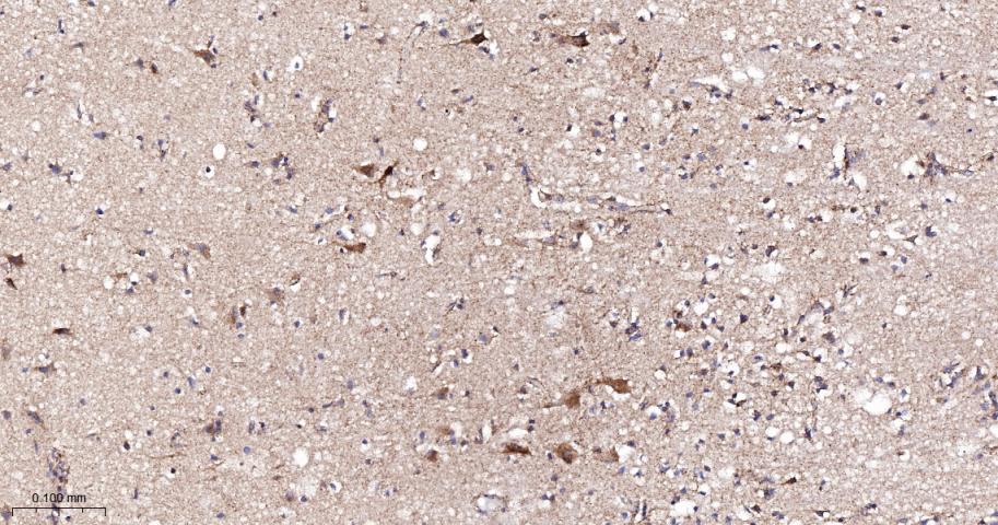 NDUFC2蛋白重组兔单抗