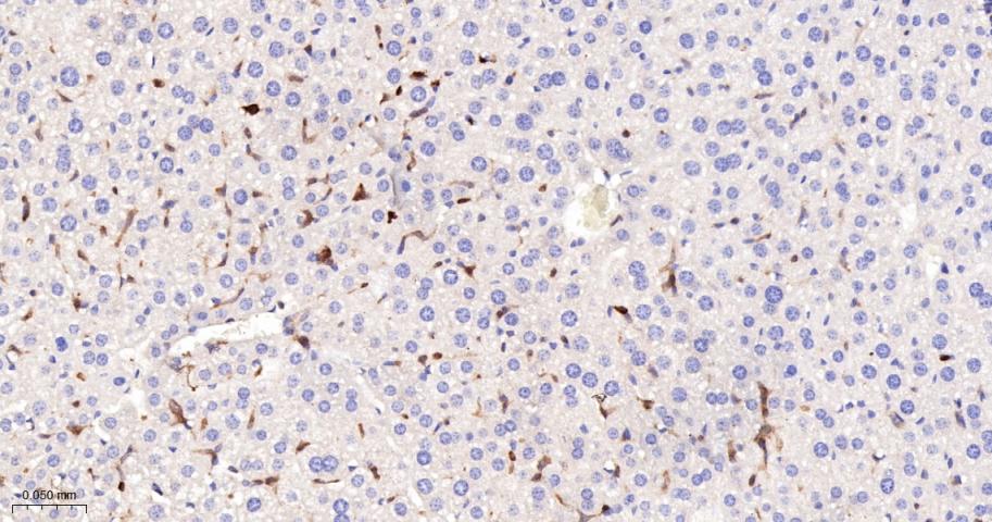 蛋白激酶C亚性D型重组兔单抗