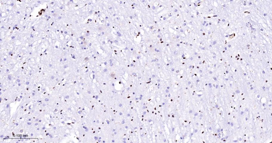 核糖核酸结合蛋白1重组兔单抗-bsm-60550R