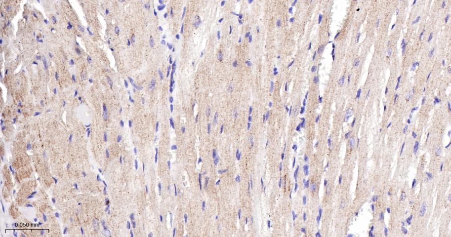肉毒碱棕榈酰基转移酶2重组兔单抗