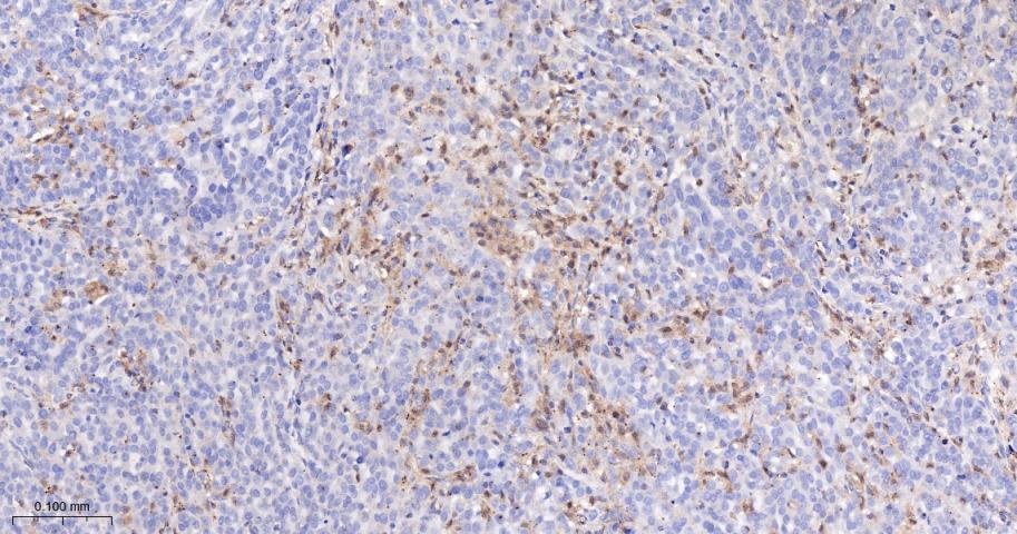 干扰素调节因子5重组兔单抗